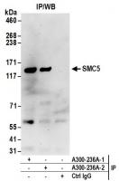 Detection of human SMC5 by western blot