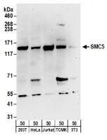Detection of human and mouse SMC5 by wes