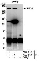 Detection of human SMG1 by western blot
