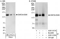 Detection of human SNF2h/ISWI by western