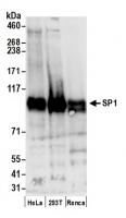 Detection of human and mouse SP1 by west