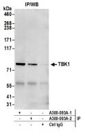 Detection of human TBK1 by western blot