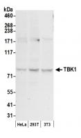 Detection of human and mouse TBK1 by wes
