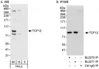 Detection of human TCF12 by western blot