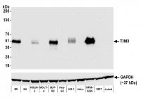 Detection of human TIM3 by western blot.