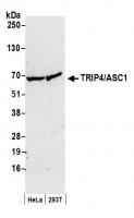 Detection of human TRIP4/ASC1 by western