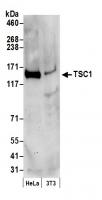 Detection of human and mouse TSC1 by wes