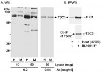 Detection of human and mouse TSC1 by wes