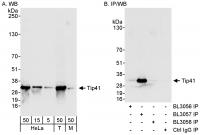 Detection of human and mouse Tip41 by we