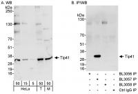 Detection of human and mouse Tip41 by we
