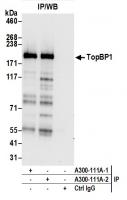 Detection of human TopBP1 by western blo