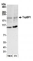 Detection of mouse TopBP1 by western blo
