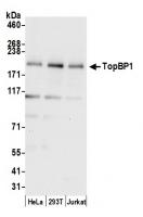 Detection of human TopBP1 by western blo