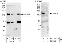 Detection of human USP15 by western blot