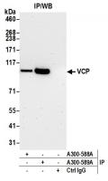 Detection of human VCP by western blot o