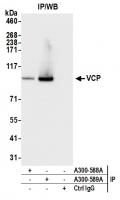 Detection of human VCP by western blot o