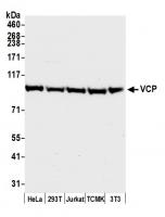 Detection of human and mouse VCP by west