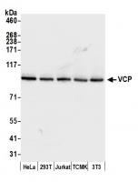Detection of human and mouse VCP by west