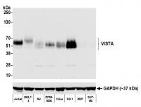 Detection of human VISTA by western blot