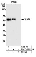 Detection of human VISTA by western blot