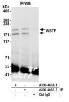 Detection of human WSTF by western blot