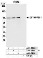 Detection of human ZBTB7/FBI-1 by wester