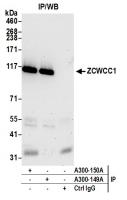 Detection of human ZCWCC1 by western blo