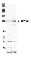 Detection of human ZCWCC1 by western blo
