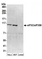 Detection of human eIF3C/eIF3S8 by weste