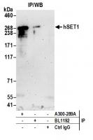 Detection of human hSET1 by western blot