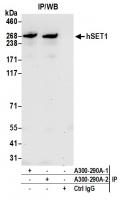 Detection of human hSET1 by western blot
