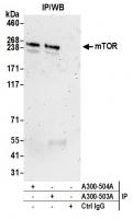Detection of human mTOR by western blot