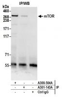 Detection of human mTOR by western blot