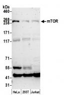 Detection of human mTOR by western blot.