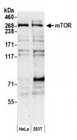 Detection of human mTOR by western blot.