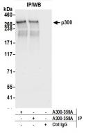 Detection of human p300 by western blot