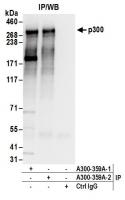 Detection of human p300 by western blot