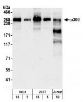 Detection of human p300 by western blot.