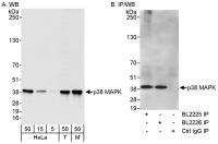 Detection of human and mouse p38 MAPK by