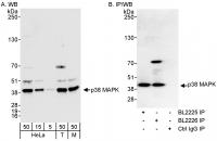 Detection of human and mouse p38 MAPK by
