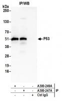 Detection of human P53 by western blot o
