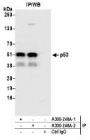 Detection of human p53 by western blot o