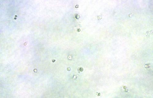 Inhibition of HeLa Cell Anchorage-Indepe