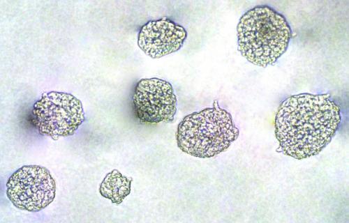 Inhibition of HeLa Cell Anchorage-Indepe