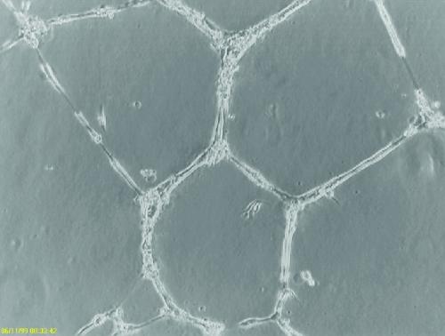 HUVEC Tube Formation on ECM Gel. HUVEC c