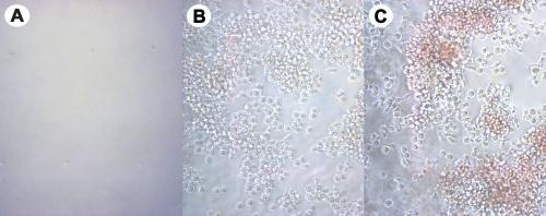 HSC Colony Formation. Human bone marrow