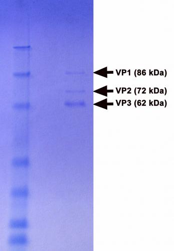 Electrophoretic Profile of AAV2-GFP Puri