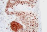 Immunohistochemistry (Formalin/PFA-fixed
