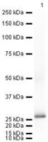 Western blot ; Anti-Prion protein PrP an