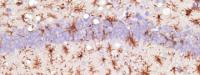 Immunohistochemistry (Formalin/PFA-fixed